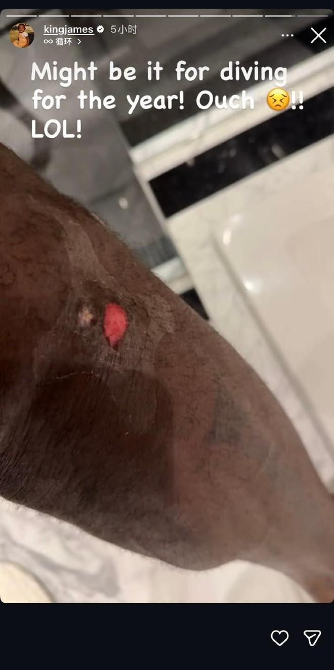 詹姆斯飞身救球重伤引热议 湖人险胜掘金